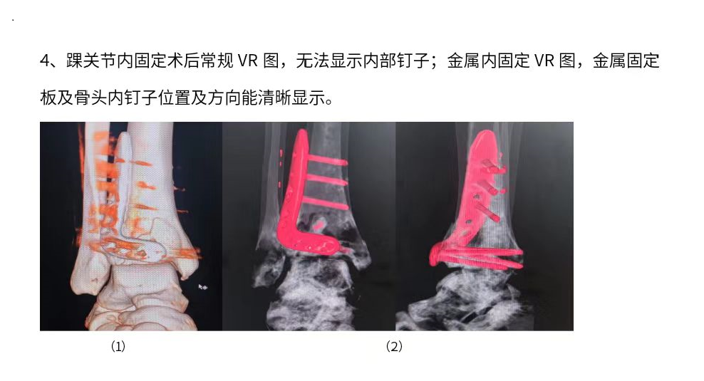 影像科 新技術(shù)臨床應(yīng)用周刊第8季