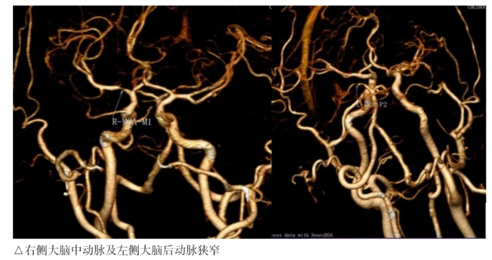 影像科 新技術(shù)臨床應(yīng)用周刊第8季