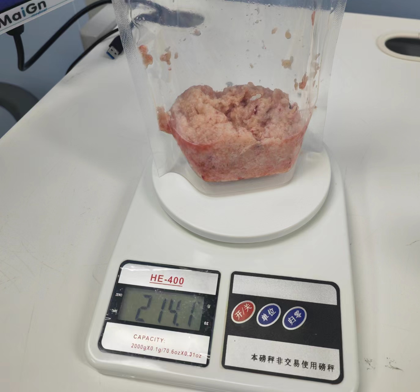 泌尿外科一病區(qū)巨大前列腺剜除