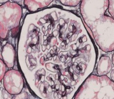 發(fā)病機(jī)理