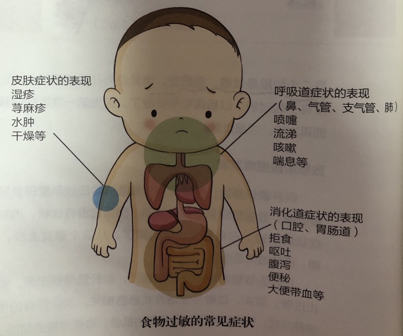 過(guò)敏1.jpg