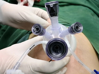 不留疤的手術(shù)，還得這樣做